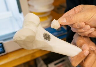 3D printed bone scaffolds