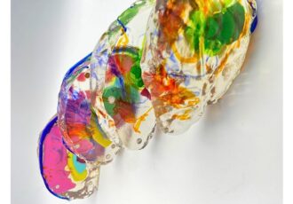 3D printed brain model for surgical planning