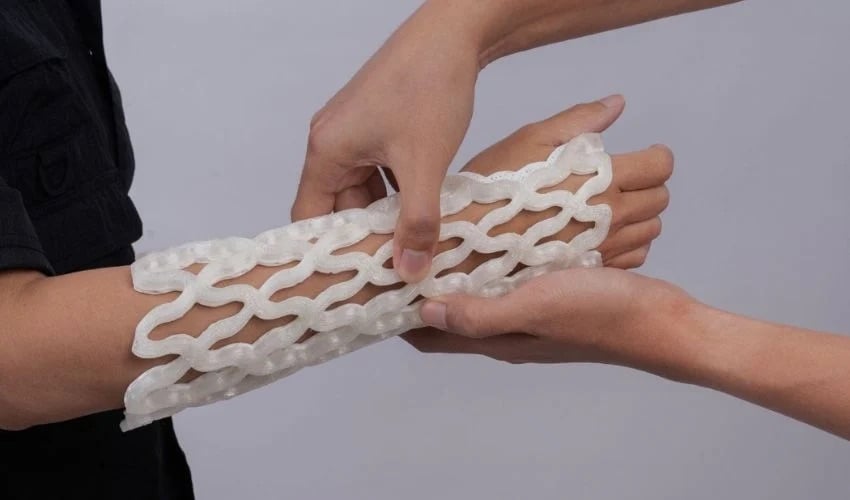 4D Printed Cast