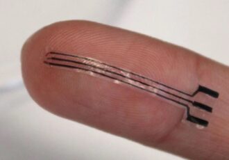 3D-printed hydrogel implant
