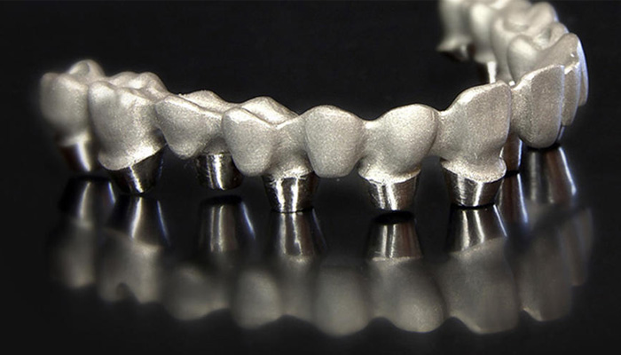 3d printing dental