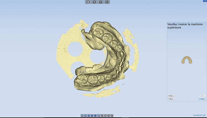 dental 3d scanner