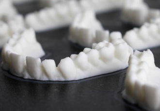 3d printing dental
