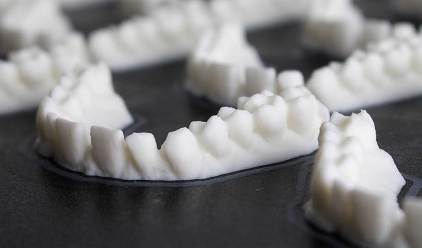 3d printing dental