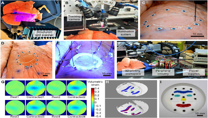 3D printing onto expanding organs