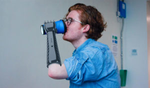 3D printed prosthetic arm