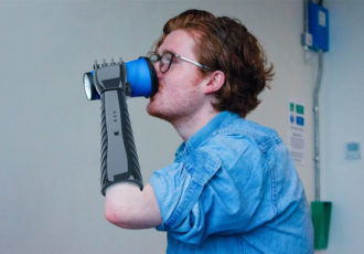 3D printed prosthetic arm