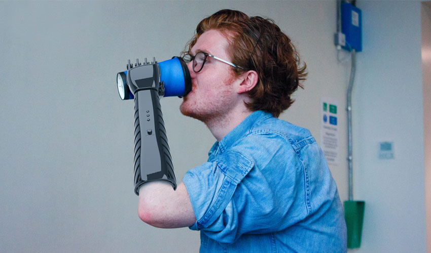 3D printed prosthetic arm