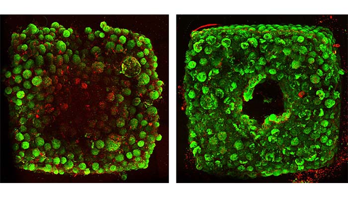 bioprinting