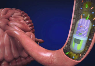 3D printed pill intestinal diseases