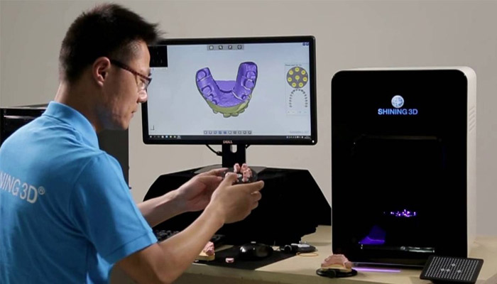 dental 3d printing