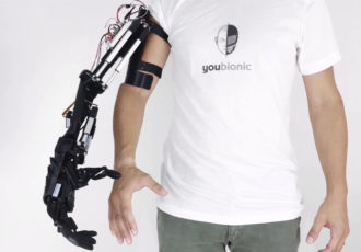 bionic arm