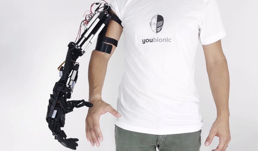 bionic arm