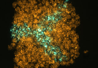 3D printed tissue