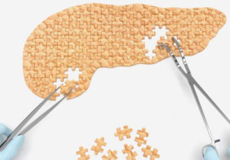 bionic pancreas