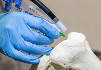 3D printing bone
