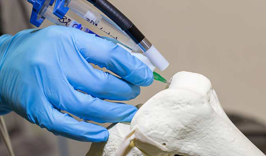 3D printing bone