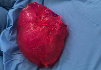 BIOLIFE4D bioprints small human heart