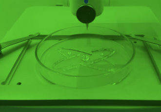 3d printed bionic pancreas