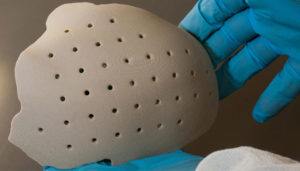 peek plastic implant peek plastic implant