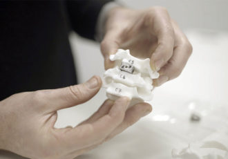 spinal implants