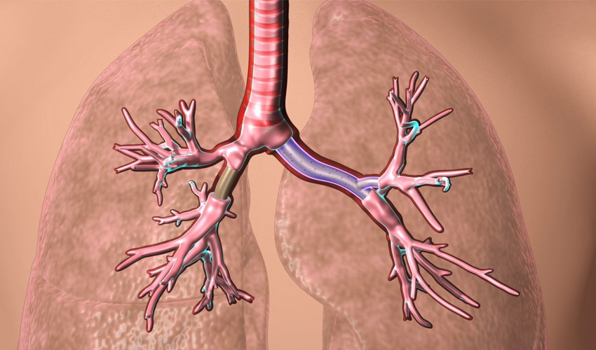 3d printed stents