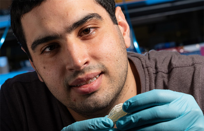 blood vessels 3D printed with sugar