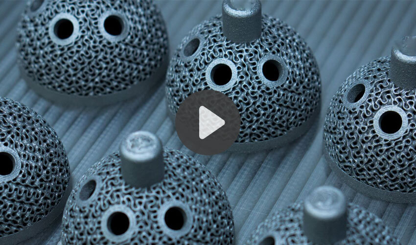 additive manufacturing implants