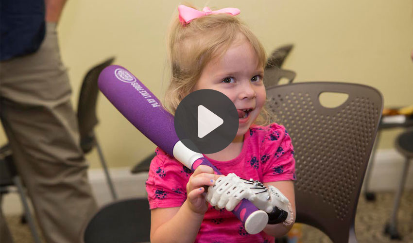 girl's 3D printed hand