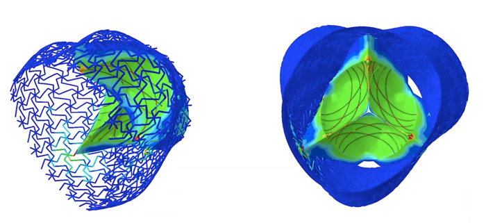 3D printed heart valve