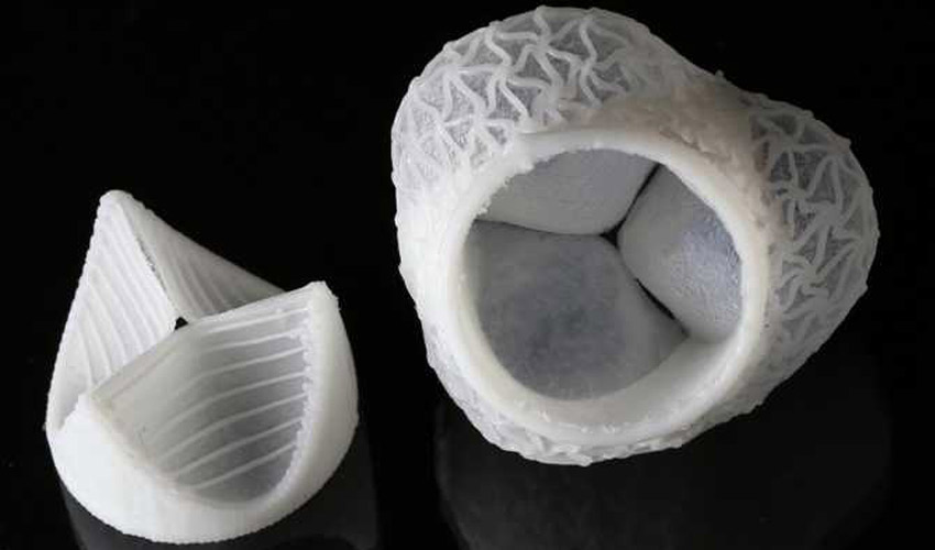 3D printed heart valves