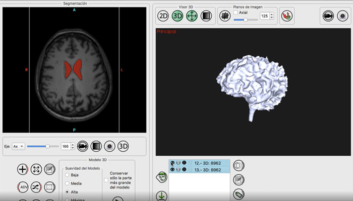 workshop dicom impresión 3D