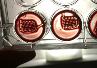 implantes personalizados 3D