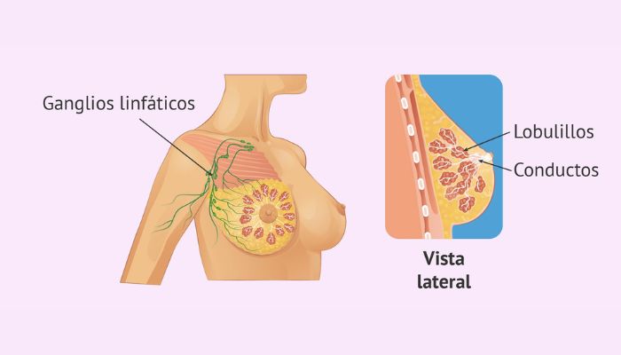 Lugar donde se originan los dos cáncer de mama más comunes