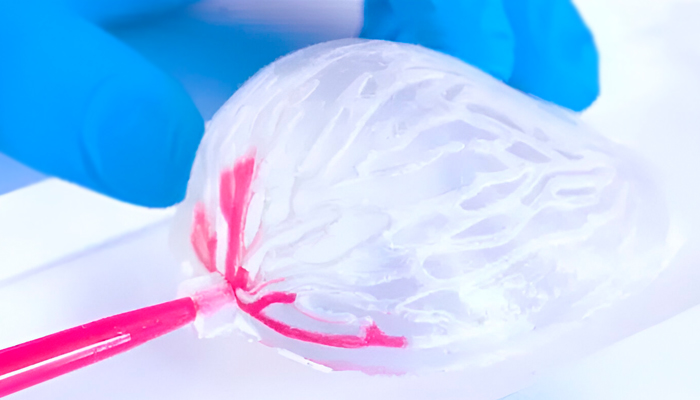 impresión 3D cáncer mama