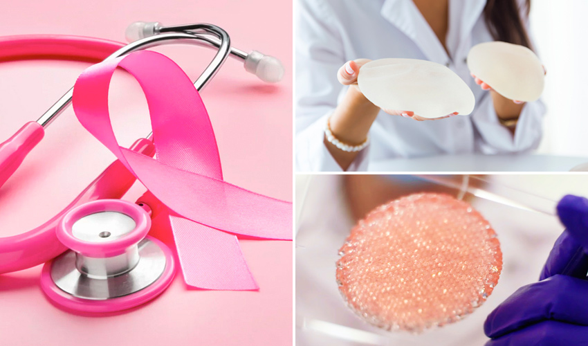 impresión 3D cáncer mama