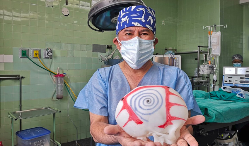 impresión 3D operación cráneo