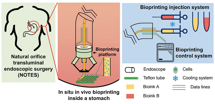 Bioprinting onto stomach