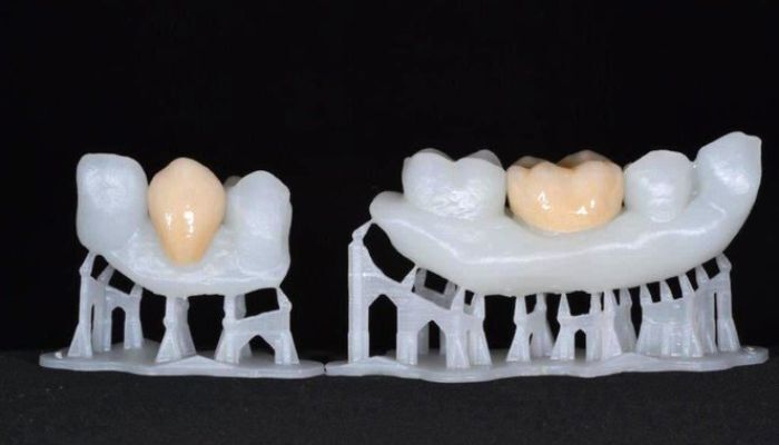 impresión 3D sector dental