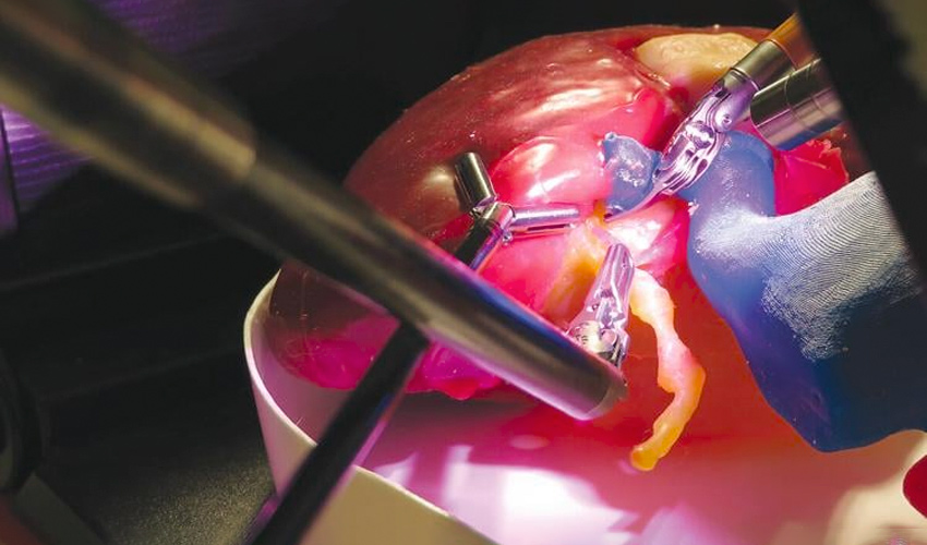 impresión 3D órganos cirugía