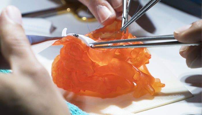 impresión 3D medicina