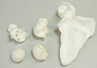 impresión 3d modelos óseos