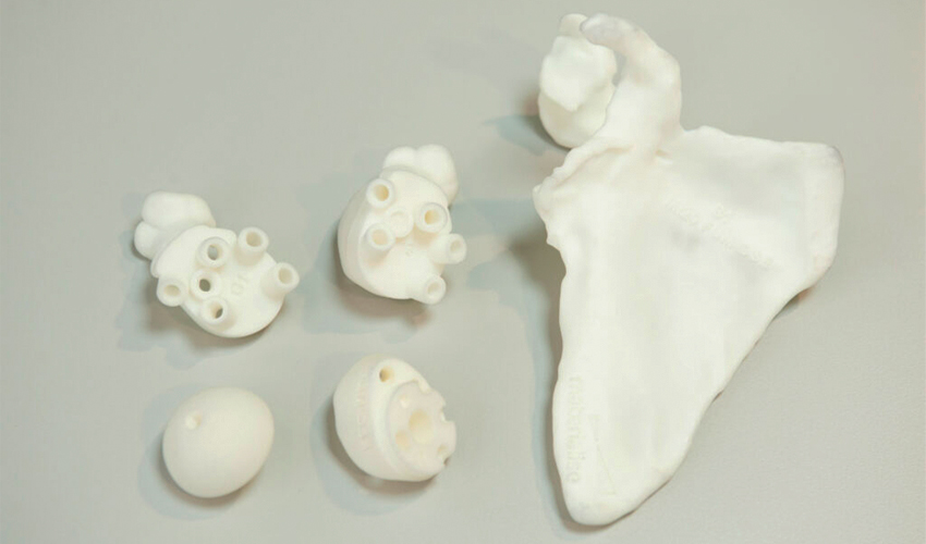impresión 3d modelos óseos