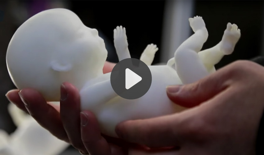 impresión 3D de bebes