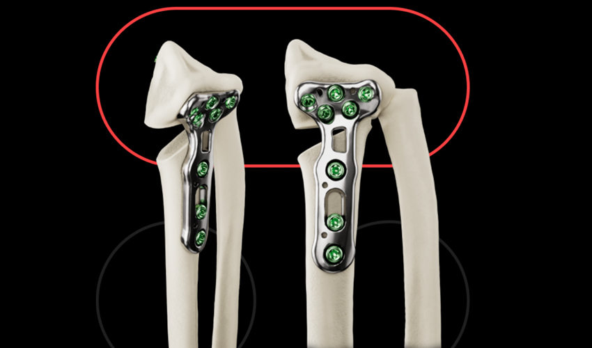 Tailor surgery and the use of additive manufacturing as a tool in medicine