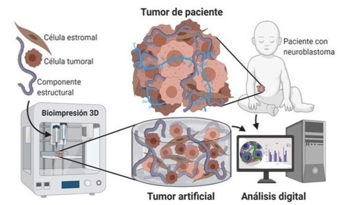 tecnología 3D cáncer infantil
