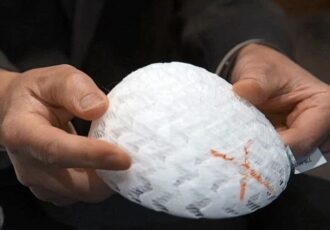 Un andamio impreso en 3D podría sustituir pronto a los implantes mamarios convencionales