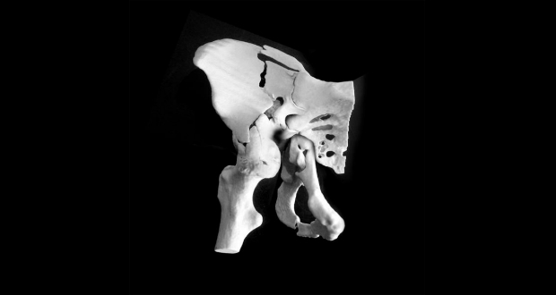 Los modelos ortopédicos 3D son elaborados a partir de CT 2D y resonancia magnética de datos.