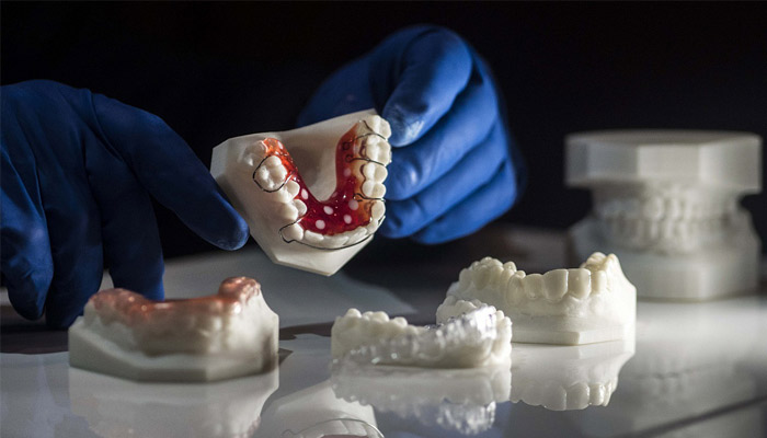 impresión 3D en la odontología