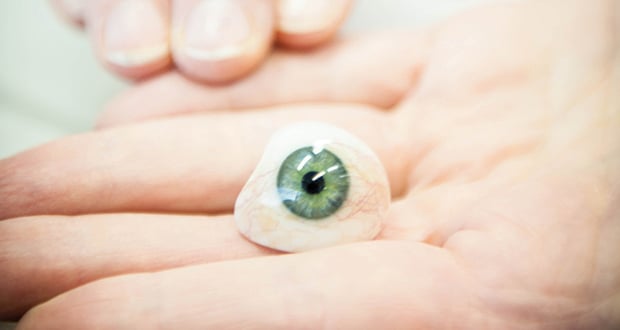 Prótesis ocular